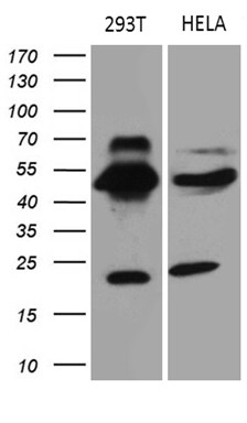 TEKT2 Antibody (OTI1E6) Western Blot;TEKT2 Antibody (OTI1E6)[NBP3-44848]-