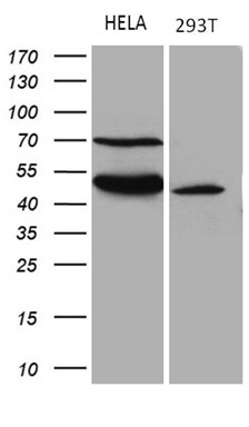 TEKT2 Antibody (OTI1E11) Western Blot;TEKT2 Antibody (OTI1E11)[NBP3-44849]-
