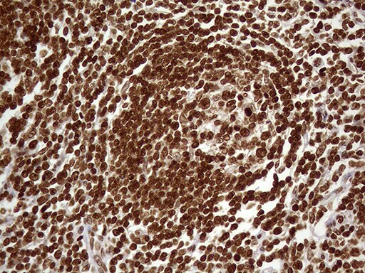 DDX19A Antibody (OTI3C12) Immunohistochemistry;DDX19A Antibody (OTI3C12)[NBP3-44850]-