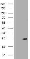 gamma C Crystallin Antibody (OTI1E3)