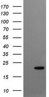 gamma C Crystallin Antibody (OTI1D6)