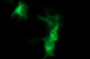 Tyrosine Hydroxylase Antibody (OTI2E6) Immunocytochemistry/ Immunofluorescence;Tyrosine Hydroxylase Antibody (OTI2E6)[NBP3-44859]-