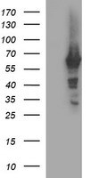 Tyrosine Hydroxylase Antibody (OTI2E6) Western Blot;Tyrosine Hydroxylase Antibody (OTI2E6)[NBP3-44859]-