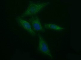 Tyrosine Hydroxylase Antibody (OTI3G3) Immunocytochemistry/ Immunofluorescence;Tyrosine Hydroxylase Antibody (OTI3G3)[NBP3-44861]-