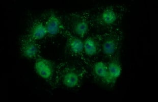 Tyrosine Hydroxylase Antibody (OTI2D4) Immunocytochemistry/ Immunofluorescence;Tyrosine Hydroxylase Antibody (OTI2D4)[NBP3-44862]-