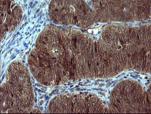 Tyrosine Hydroxylase Antibody (OTI2D4) Immunohistochemistry;Tyrosine Hydroxylase Antibody (OTI2D4)[NBP3-44862]-