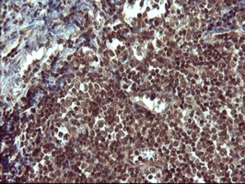Tyrosine Hydroxylase Antibody (OTI2D4) Immunohistochemistry;Tyrosine Hydroxylase Antibody (OTI2D4)[NBP3-44862]-
