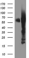 Tyrosine Hydroxylase Antibody (OTI2D4) Western Blot;Tyrosine Hydroxylase Antibody (OTI2D4)[NBP3-44862]-