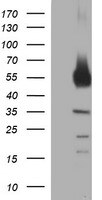 Tyrosine Hydroxylase Antibody (OTI1D8)