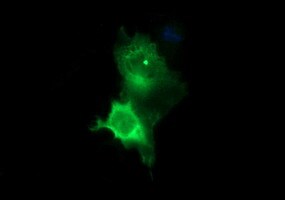 Tyrosine Hydroxylase Antibody (OTI1A4) Immunocytochemistry/ Immunofluorescence;Tyrosine Hydroxylase Antibody (OTI1A4)[NBP3-44864]-