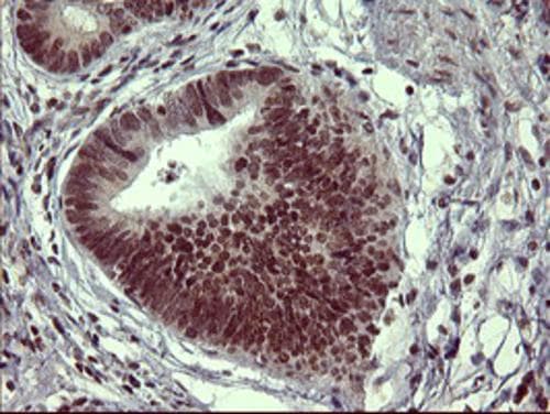 Tyrosine Hydroxylase Antibody (OTI1A4) Immunohistochemistry;Tyrosine Hydroxylase Antibody (OTI1A4)[NBP3-44864]-