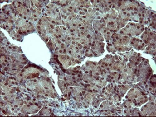 Tyrosine Hydroxylase Antibody (OTI1A4) Immunohistochemistry;Tyrosine Hydroxylase Antibody (OTI1A4)[NBP3-44864]-
