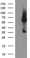 Tyrosine Hydroxylase Antibody (OTI1A4) Western Blot;Tyrosine Hydroxylase Antibody (OTI1A4)[NBP3-44864]-