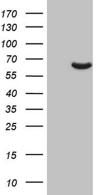 PAPSS2 Antibody (OTI2E7)
