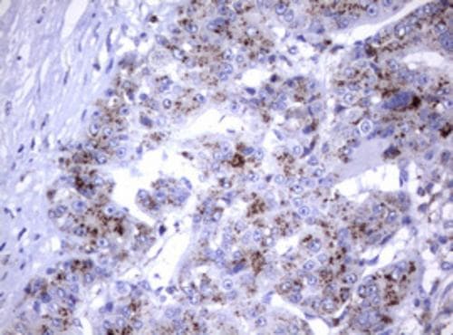 NEU-1/Sialidase-1 Antibody (OTI3B3) Immunohistochemistry;NEU-1/Sialidase-1 Antibody (OTI3B3)[NBP3-44875]-