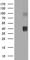 NEU-1/Sialidase-1 Antibody (OTI3B3) Western Blot;NEU-1/Sialidase-1 Antibody (OTI3B3)[NBP3-44875]-