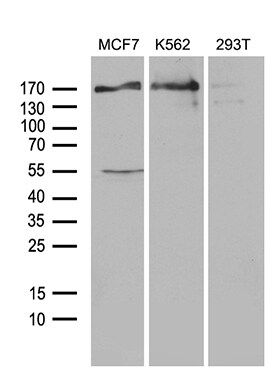 USP40 Antibody (OTI2C5) Western Blot;USP40 Antibody (OTI2C5)[NBP3-44885]-