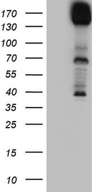 DCC Antibody (OTI5D10) Western Blot;DCC Antibody (OTI5D10)[NBP3-44889]-