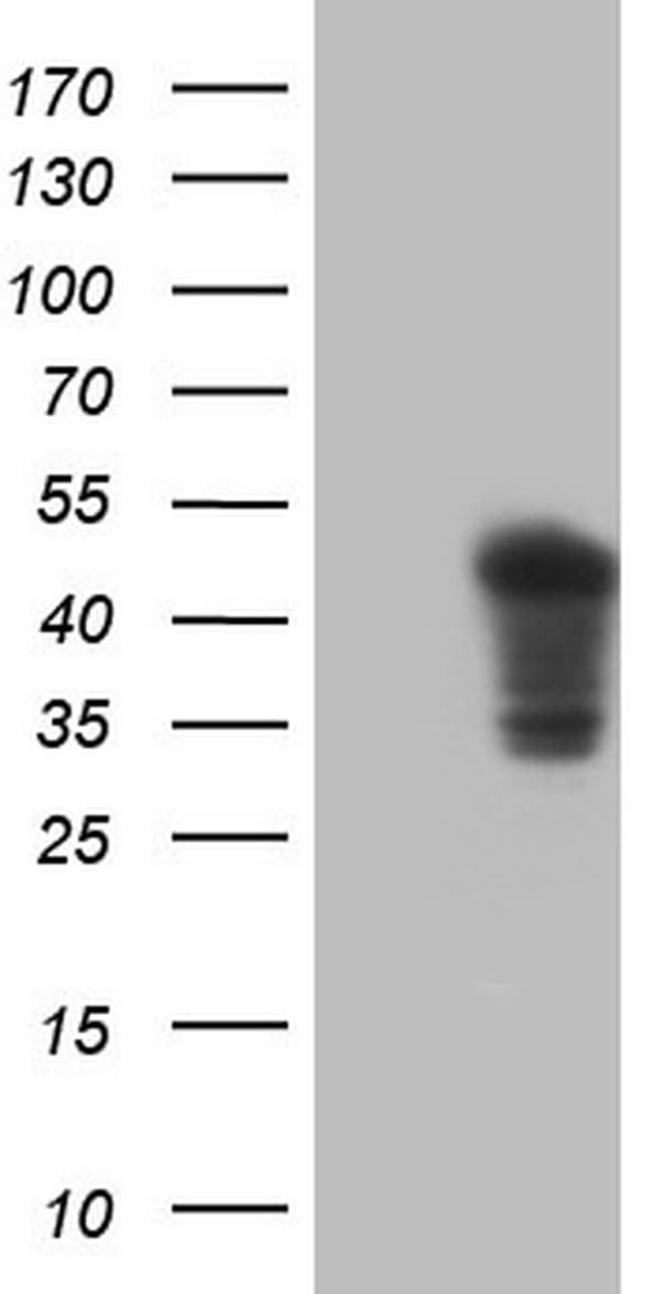 Cardiac Troponin T Antibody (OTI1G9)