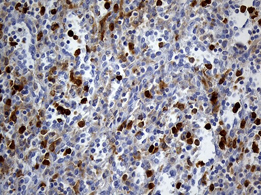 UBE3B Antibody (OTI3F10) Immunohistochemistry;UBE3B Antibody (OTI3F10)[NBP3-44892]-