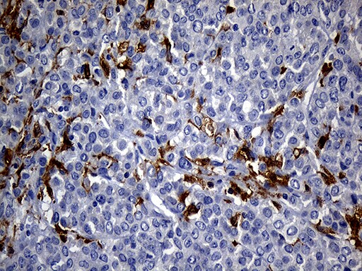 UBE3B Antibody (OTI3F10) Immunohistochemistry;UBE3B Antibody (OTI3F10)[NBP3-44892]-