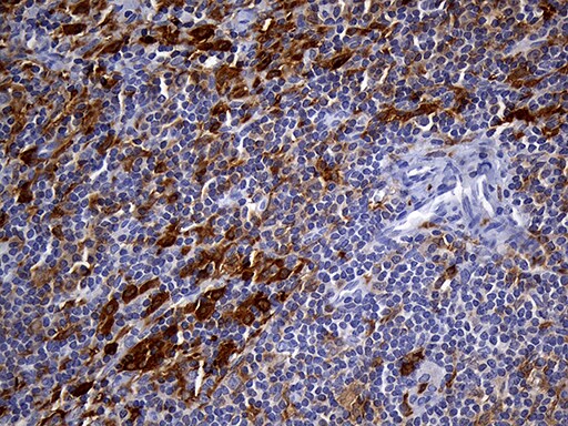 UBE3B Antibody (OTI3F10) Immunohistochemistry;UBE3B Antibody (OTI3F10)[NBP3-44892]-
