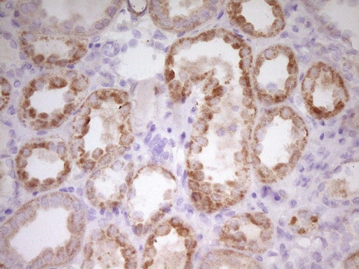 PAPSS2 Antibody (OTI3H10)