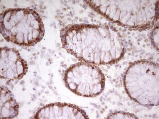 PAPSS2 Antibody (OTI3H10)