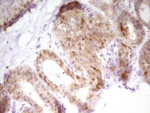 PAPSS2 Antibody (OTI3H10)