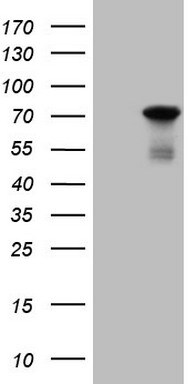 PAPSS2 Antibody (OTI5H3) Western Blot;PAPSS2 Antibody (OTI5H3)[NBP3-44894]-
