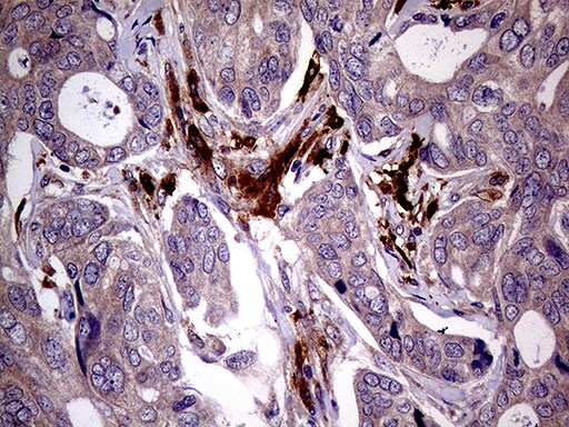JIP1 Antibody (OTI1D9) Immunohistochemistry;JIP1 Antibody (OTI1D9)[NBP3-44895]-