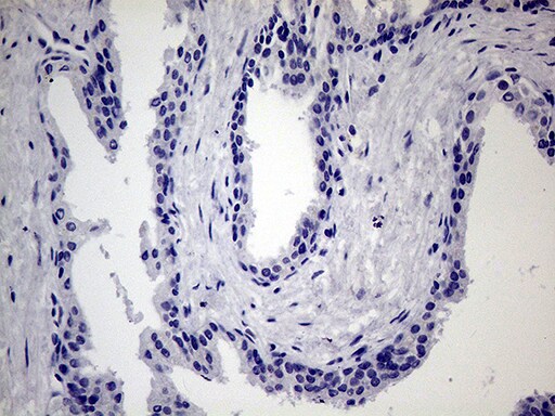 JIP1 Antibody (OTI1D9) Immunohistochemistry;JIP1 Antibody (OTI1D9)[NBP3-44895]-
