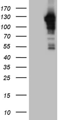 JIP1 Antibody (OTI1D9) Western Blot;JIP1 Antibody (OTI1D9)[NBP3-44895]-