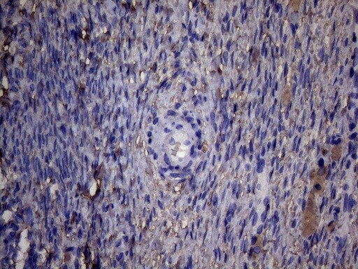 PAPSS2 Antibody (OTI6H10)