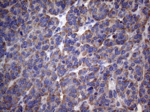 PAPSS2 Antibody (OTI6H10)