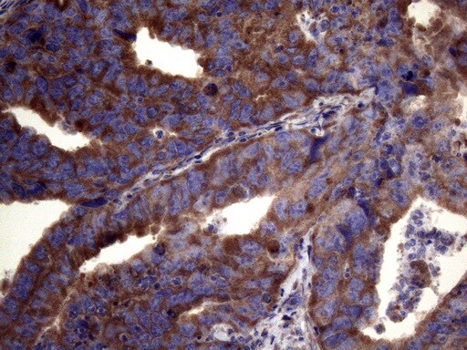 PAPSS2 Antibody (OTI6H10)