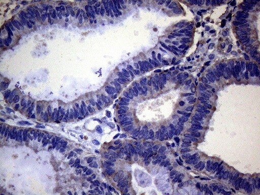 PAPSS2 Antibody (OTI6H10) Immunohistochemistry;PAPSS2 Antibody (OTI6H10)[NBP3-44898]-