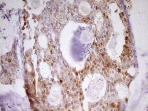 PAPSS2 Antibody (OTI2E7) Immunohistochemistry;PAPSS2 Antibody (OTI2E7)[NBP3-44899]-