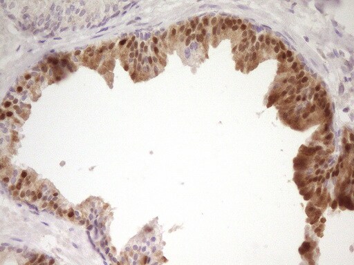 PAPSS2 Antibody (OTI2E7) Immunohistochemistry;PAPSS2 Antibody (OTI2E7)[NBP3-44899]-