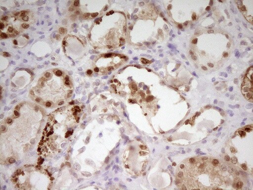 PAPSS2 Antibody (OTI2E7) Immunohistochemistry;PAPSS2 Antibody (OTI2E7)[NBP3-44899]-