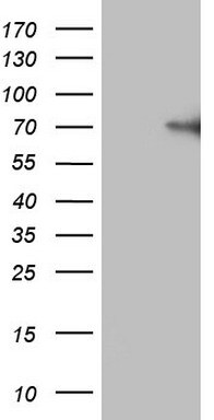 Factor XII Antibody (OTI2D12) Western Blot;Factor XII Antibody (OTI2D12)[NBP3-44900]-