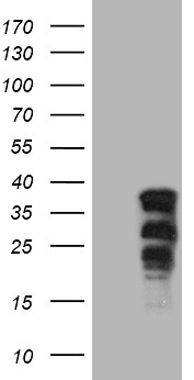 SOX21 Antibody (OTI7D5) Western Blot;SOX21 Antibody (OTI7D5)[NBP3-44903]-
