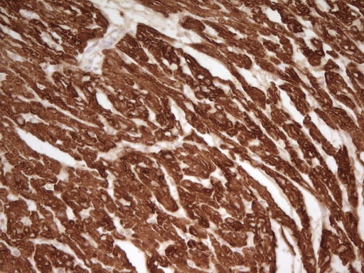 Cardiac Troponin T Antibody (OTI3C3) Immunohistochemistry;Cardiac Troponin T Antibody (OTI3C3)[NBP3-44906]-