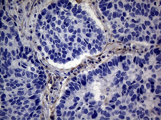 PMP22 Antibody (OTI5D1)