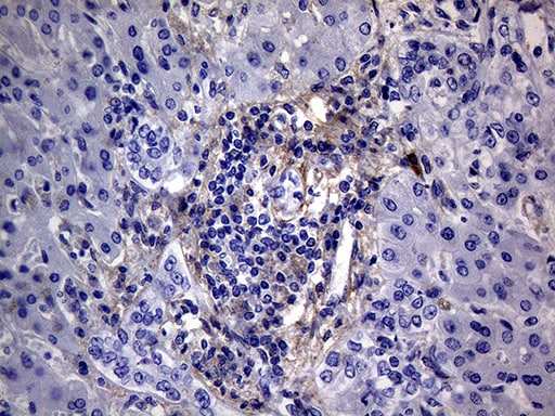 PMP22 Antibody (OTI5D1)