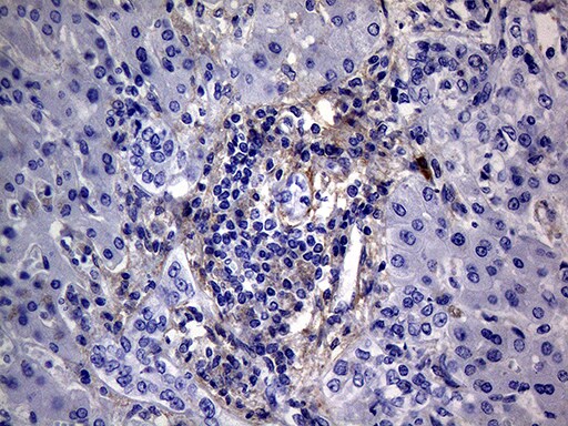 PMP22 Antibody (OTI5D1) Immunohistochemistry;PMP22 Antibody (OTI5D1)[NBP3-44912]-