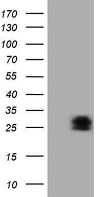PMP22 Antibody (OTI5D1)