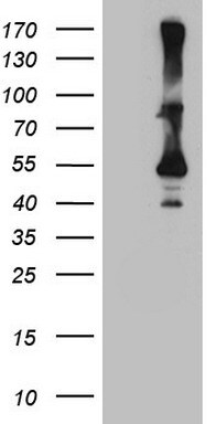Cytohesin 2 Antibody (OTI4D9)