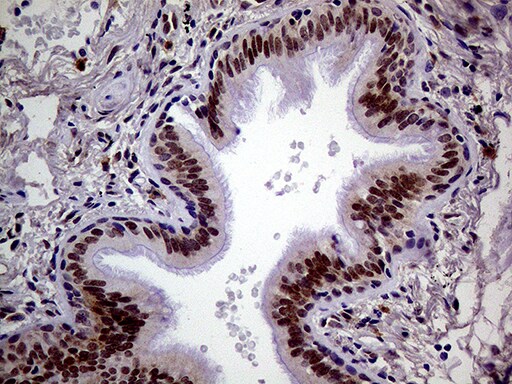MAGEB4 Antibody (OTI3H2) Immunohistochemistry;MAGEB4 Antibody (OTI3H2)[NBP3-44915]-