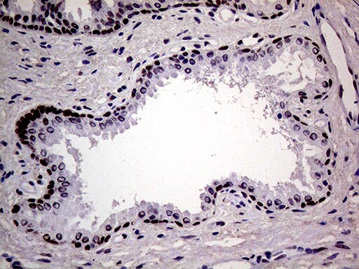 MAGEB4 Antibody (OTI3H2) Immunohistochemistry;MAGEB4 Antibody (OTI3H2)[NBP3-44915]-